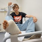 В Австралии хирурги заменили палец кисти пальцем ступни